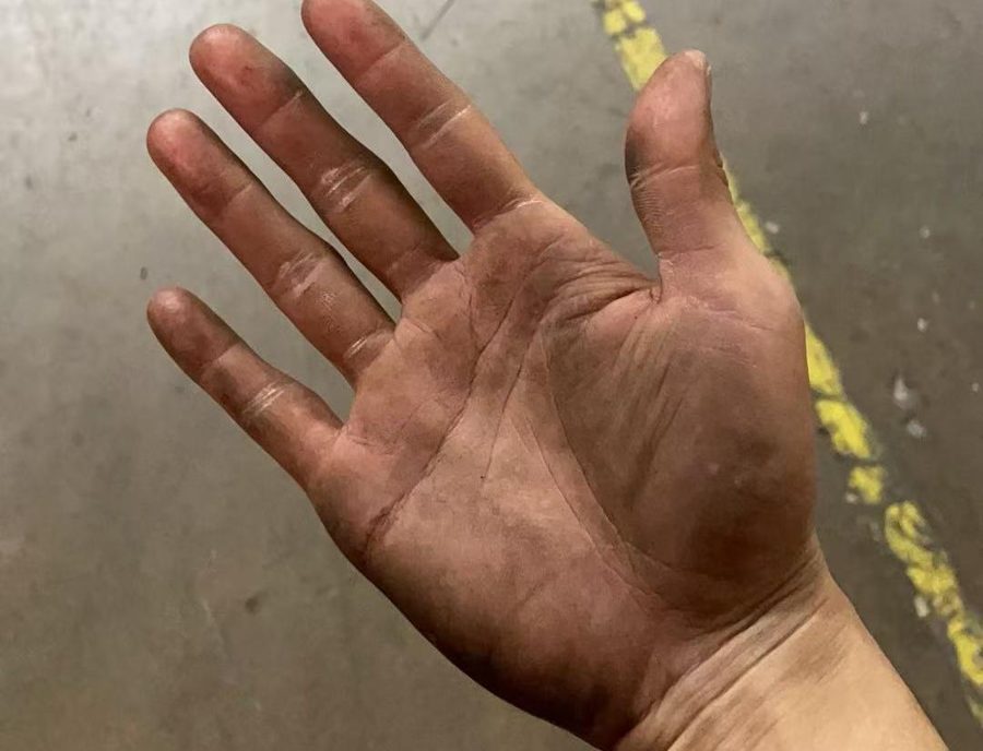 Jay's hand after a day of warehouse work